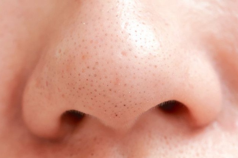 7 công dụng làm đẹp của kem đánh răng